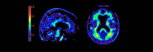 Descúbre qué porcentaje de tu cerebro utilizas